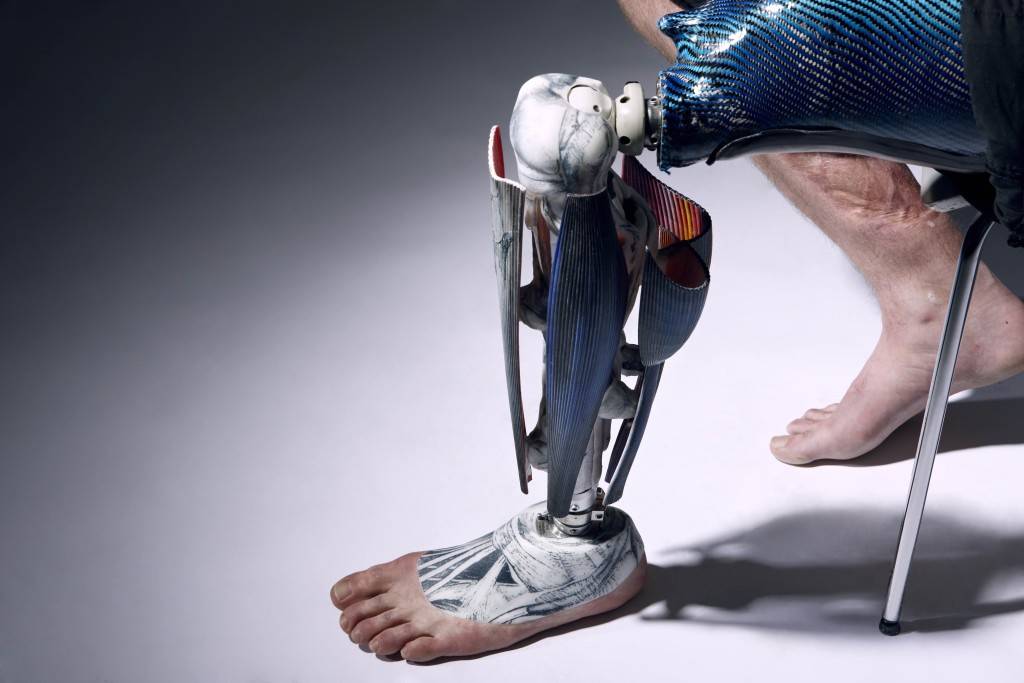 52.6-The Alternative limb project-Anatomical leg by Omkaar Kotedia high res